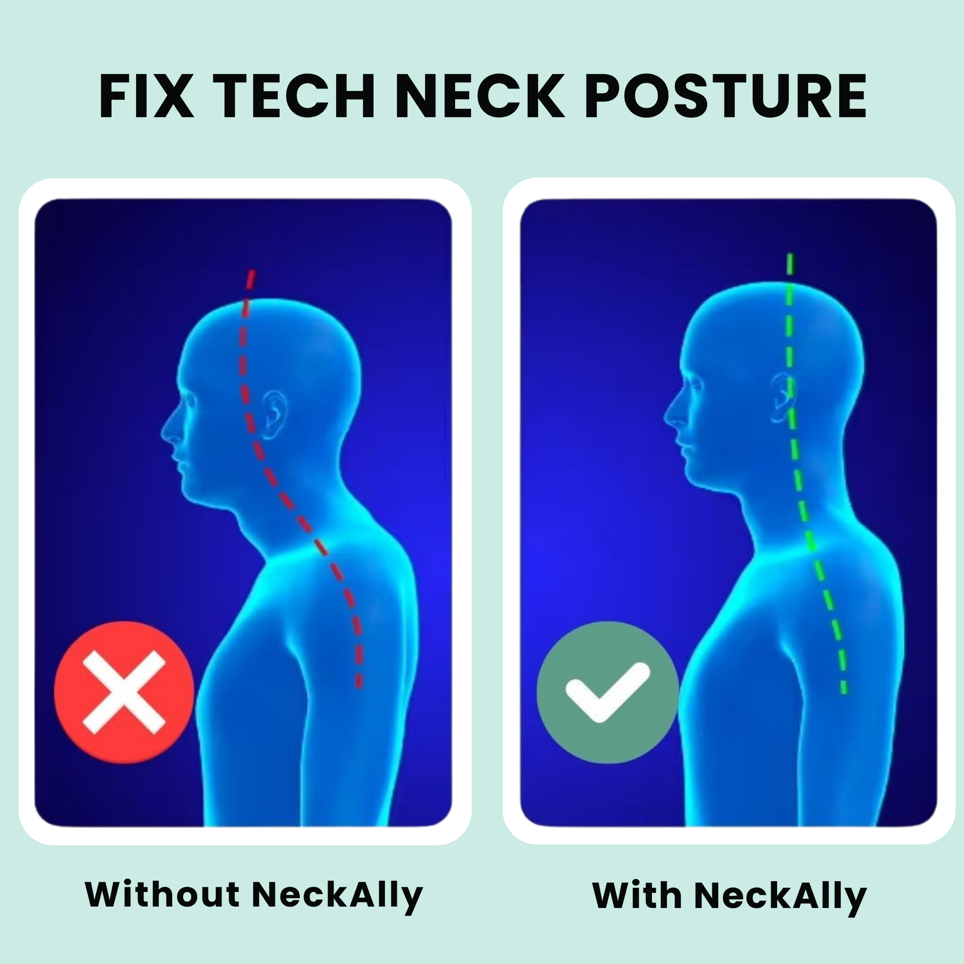 Premium NeckAlly - Glovyzone 