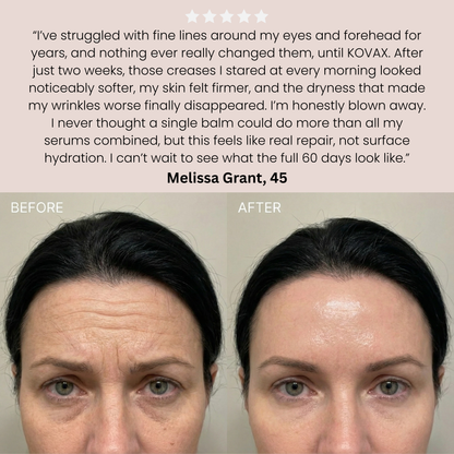 Kovax Nordic Renewal Cream - Glovyzone 