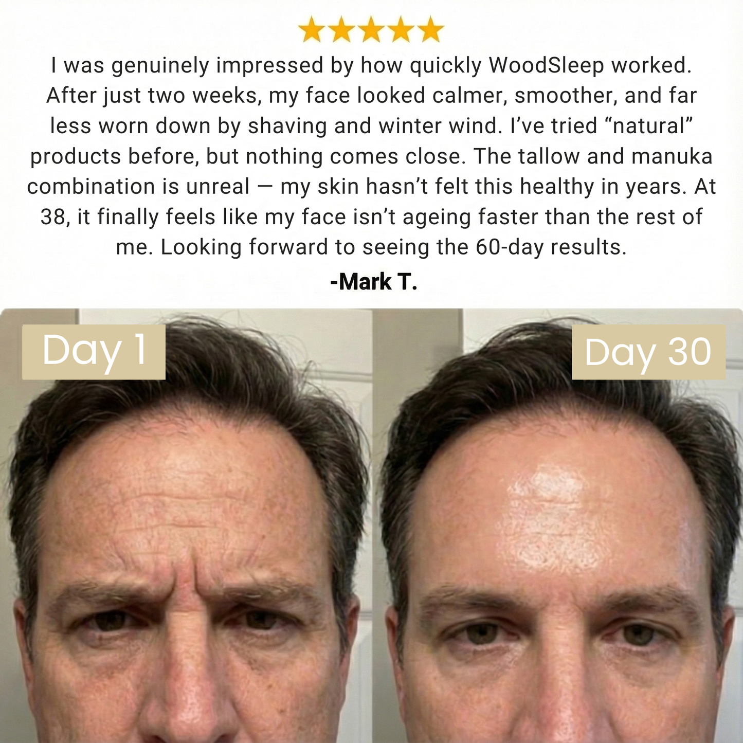 WoodSleep Beef Tallow Recovery Balm - Glovyzone 