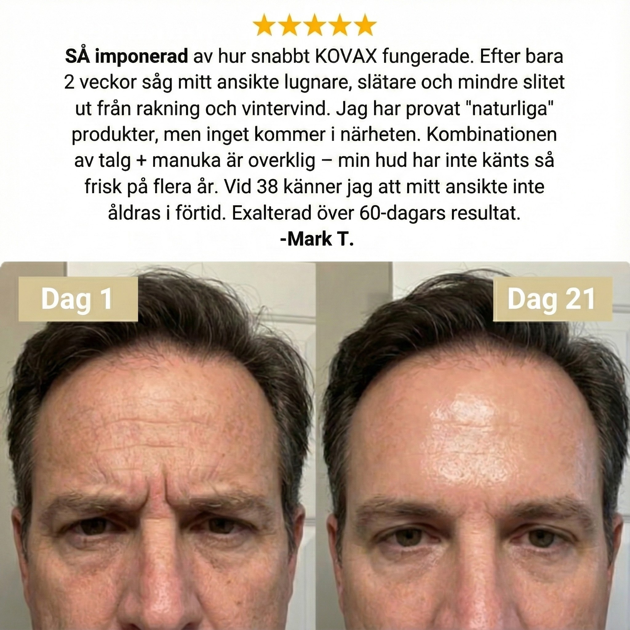 Kovax Beef Tallow Recovery Cream