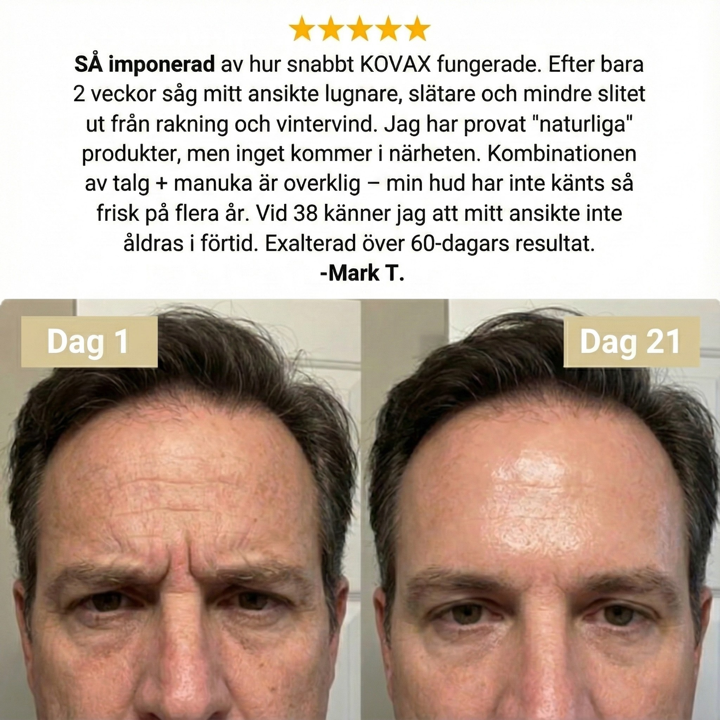 Kovax Beef Tallow Recovery Cream