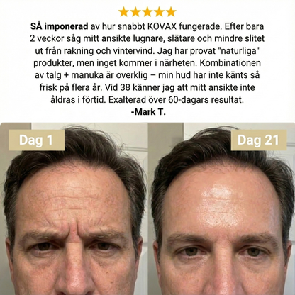 Kovax Beef Tallow Recovery Cream