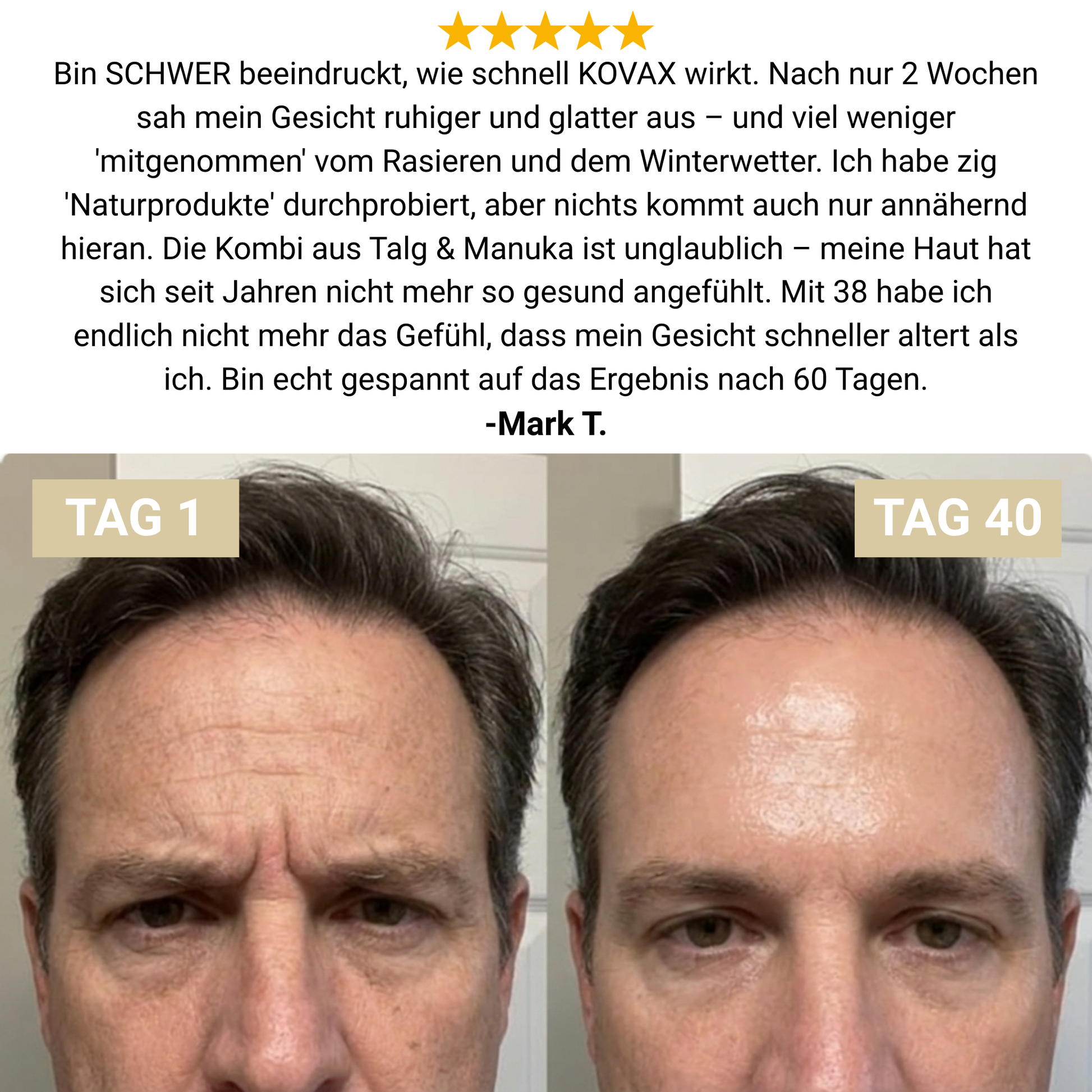 KOVAX Beef Tallow Recovery Balm - Glovyzone 